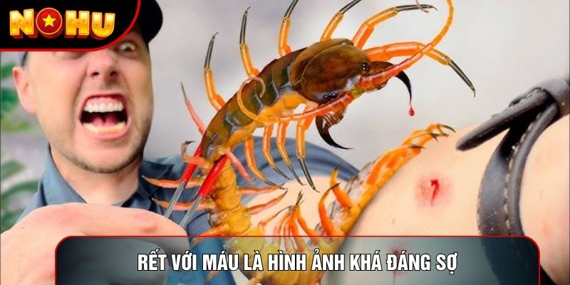 Rết với máu là hình ảnh khá đáng sợ